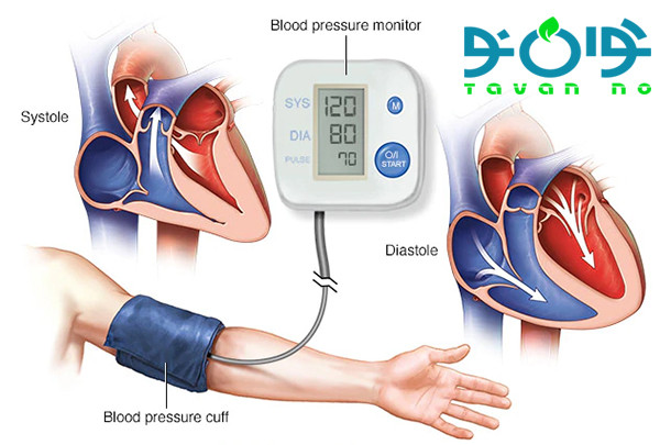 کنترل فشار خون و جلوگیری از سکته قلب و سکته مغزی -01